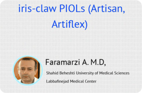 iris-claw PIOLs (Artisan, ArtiFlex)